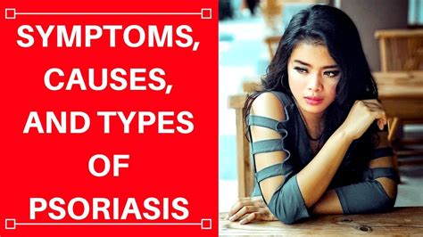 The 5 Types Of Psoriasis Causes And Symptoms Of Psoriasis Youtube