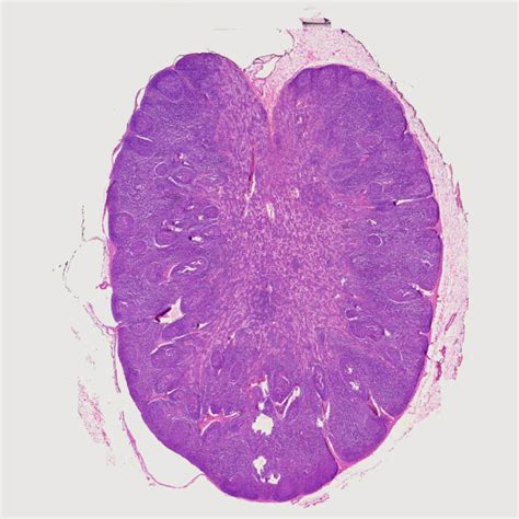 1pcs Human Lymph Node Section Through Hilum He Stain