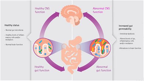 Frontiers | Migraine Associated with Gastrointestinal Disorders: Review