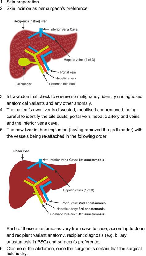 Adult Liver Transplantation Uk Clinical Guideline Part 2 Surgery