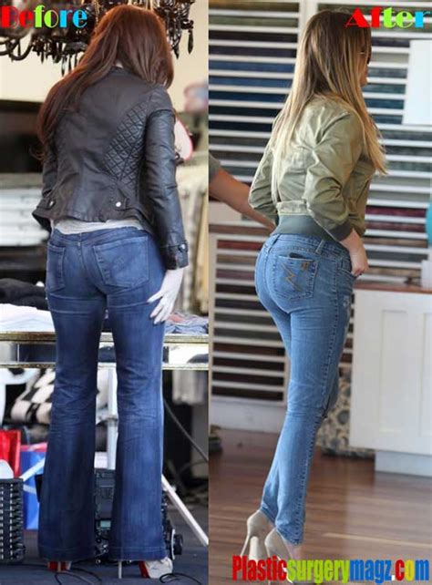 Khloe Kardashian Butt Implants Before And After Photos Plastic Surgery Magazine