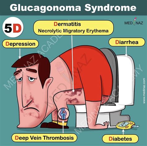 10 Symptoms Of Glucagonoma You Should Never Ignore Huffington News
