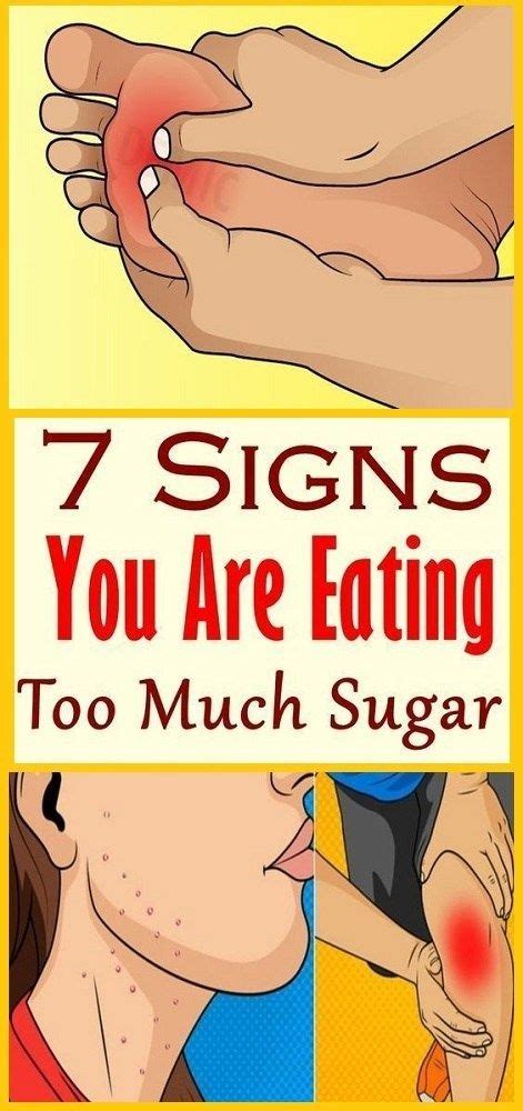 7 Signs You Are Eating Too Much Sugar V Remedies