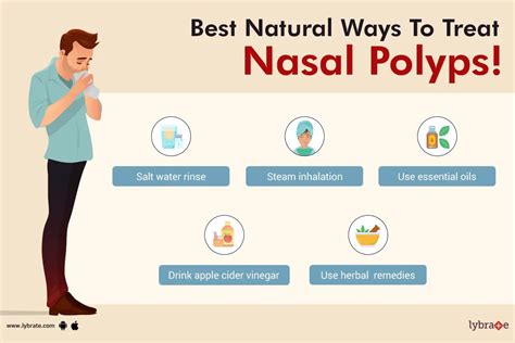 How To Prevent Nasal Polyps Ask The Nurse Expert