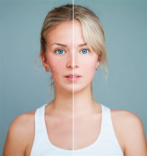 Maybe you would like to learn more about one of these? Best Anti Aging Skin Care Treatment | Tips For Glowing ...