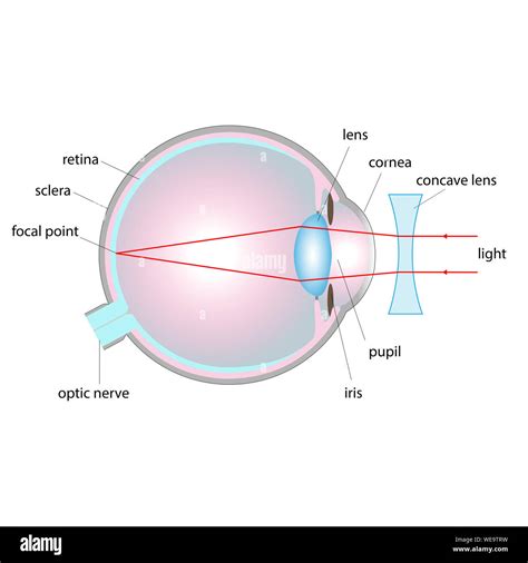 Images Formed By Concave And Convex Lenses