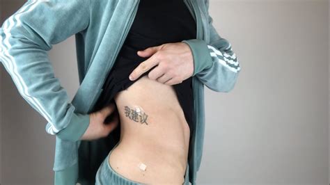 Noncancerous, precancerous and cancerous tumors. Removing potentially cancerous moles - YouTube
