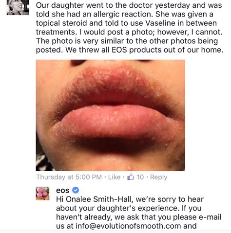 Allergic Reaction On Lips