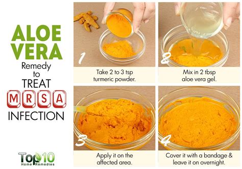 How To Treat A Mrsa Infection Naturally Top 10 Home Remedies