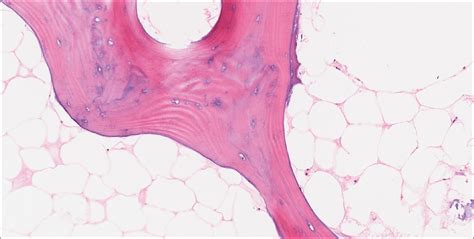 Bone Normal Histology Nus Pathweb Nus Pathweb