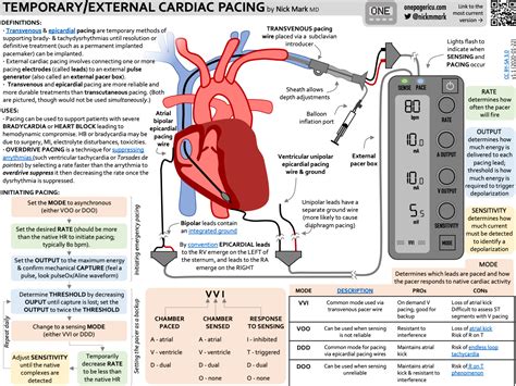 Transvenous And Epicardial Pacers — Icu One Pager