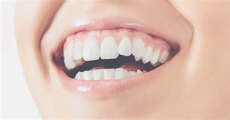 Corrección De La Sonrisa Gingival Clínica Dental Zaragoza Sur
