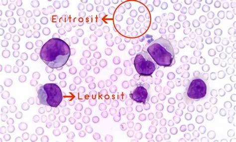 We did not find results for: Leukosit: Nilai Normal & Penyebab Nilai Tidak Normal