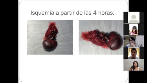 Simple Science: How to Make a Volcano with Kids