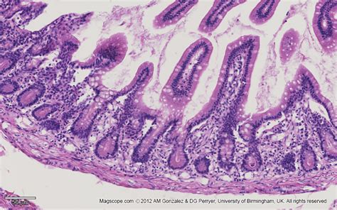 Jejunum Histology Slide With Labeled Diagram And Iden Vrogue Co