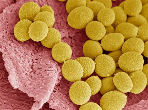 Foot fungus or fungi is known as onychomycosis, or microorganisms which are everywhere in the natural environment. BPoD | Athletes' Feet