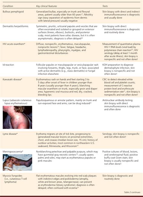 table 3 from the generalized rash part i differential diagnosis semantic scholar