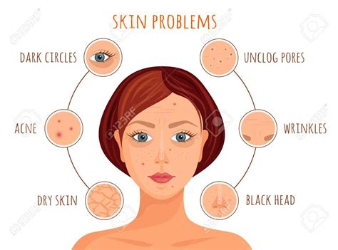 Get Rid Of All Skins Irritations Instantly With The Skin Doctor
