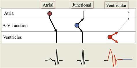 General Introduction Classification And Electrocardiographic