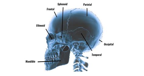 Skull Fracture In Sport Symptoms Causes And Treatment
