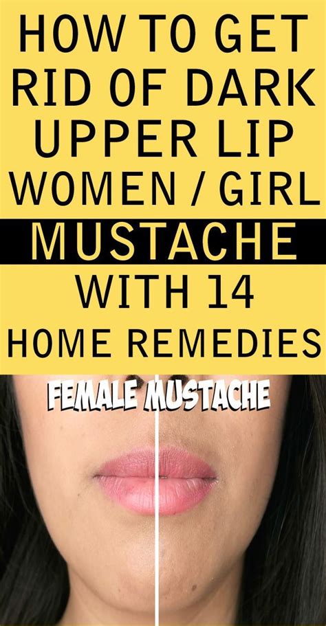 How To Get Rid Of Upper Lip Blackheads Howtormeov
