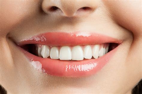 Beautiful Smile With Withe Teeth Dental Laboratory Associatesdental