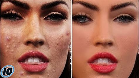 Celebrities With Bad Skin Acne
