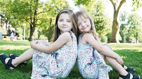 Zwillinge Mit Und Ohne Down Syndrom