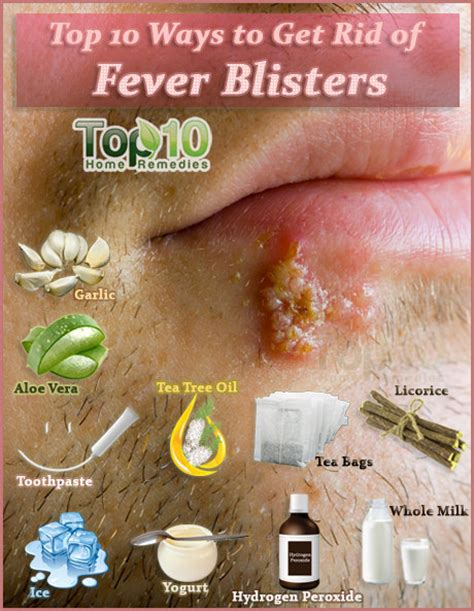 How To Get Rid Of Fever Blisters Top 10 Home Remedies