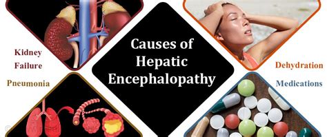Hepatic Encephalopathy Causes Types Stages Symptoms Diagnosis