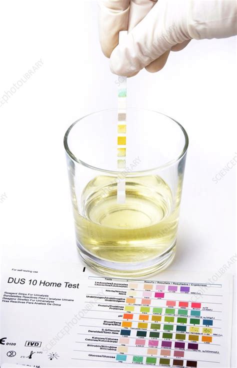 Urine Home Test Kit Stock Image C0246497 Science Photo Library