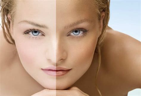 10 Easy Home Remedies To Get Lighter Skin