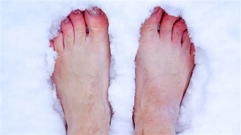 Chilblains Morecrofts Podiatry Services Lilydale