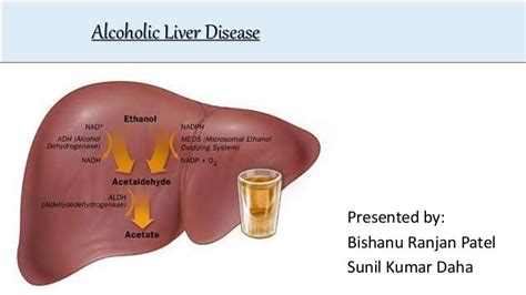 Alcoholic Liver Disease By Sunil Kumar Daha