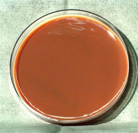 Free Picture Chocolate Agar Inoculated Gram Negative Francisella