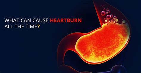 Getting Heartburn Every Day Facts Treatment Causes Symptoms