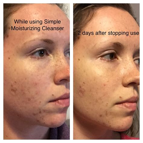 I used the face wash and based on my use i. Simple Moisturizing Facial Wash reviews, photos ...