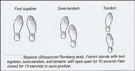 Romberg Test Physiopedia