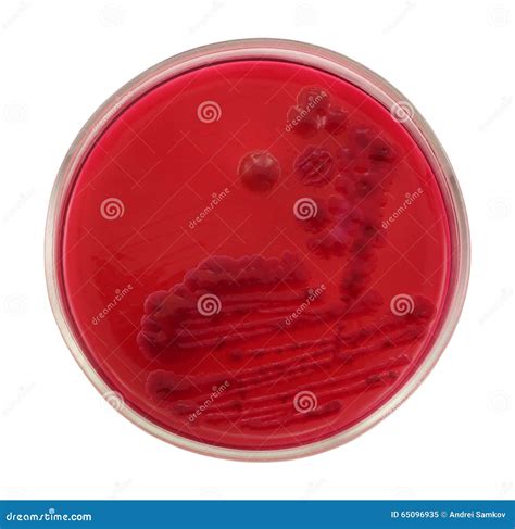 Escherichia Coli Bacteria On Columbia Blood Agar Royalty Free Stock
