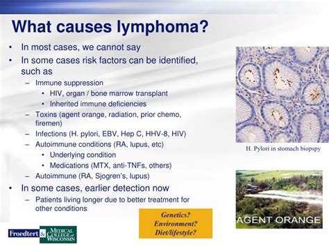 Ppt Lymphoma Overview Powerpoint Presentation Id4501266