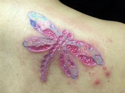 Mala Cicatrizaci N En Tatuajes Puede Provocar Infecciones En La Piel