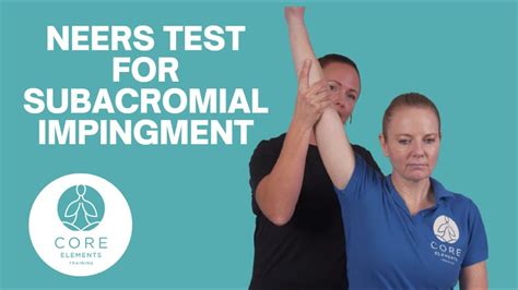 Neers Test Subacromial Pain Or Impingement Youtube