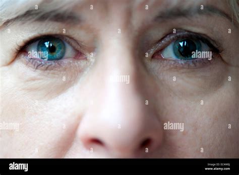 Close Up Of Eyes With Different Sized Pupils Stock Photo Alamy