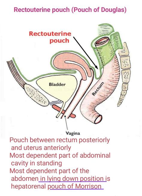 Hi i just had a pelvis ultrasound n the report states: Pouch of Douglas... | anatomy | Pinterest