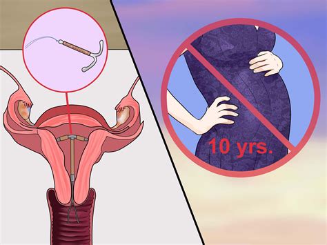 Maybe you would like to learn more about one of these? How to Use Emergency Contraceptives: 11 Steps (with Pictures)