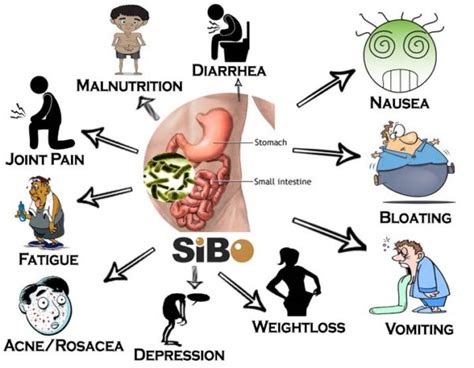 Functional Medicine Solutions For Sibo Small Intestinal Bacterial