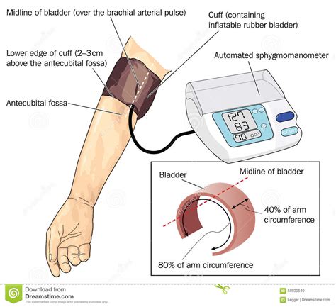 The cuff should then cover 80 percent or more of the arm. Blood pressure measurement stock vector. Illustration of ...