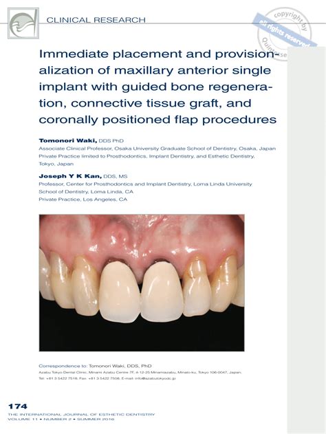 Pdf Immediate Placement And Provisionalization Of Maxillary Anterior