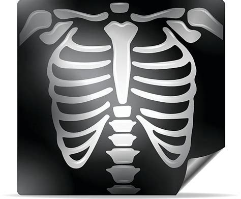 Royalty Free X Ray Clip Art Vector Images And Illustrations Istock