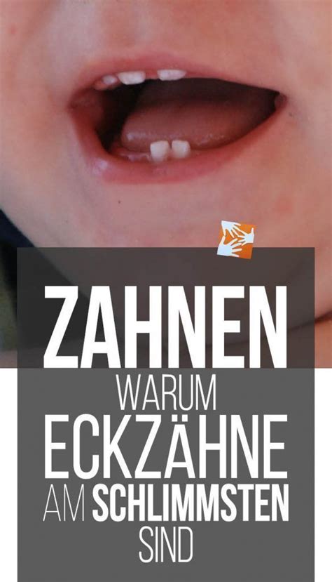 Wann sollte ich mir sorgen machen? Zahnen: Eckzähne sind die schlimmsten | Muttis Nähkästchen ...